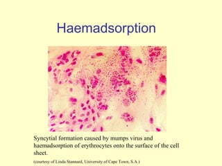 Haemadsorption




Syncytial formation caused by mumps virus and
haemadsorption of erythrocytes onto the surface of the cell
sheet.
(courtesy of Linda Stannard, University of Cape Town, S.A.)
 