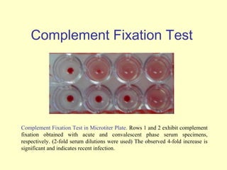Complement Fixation Test




Complement Fixation Test in Microtiter Plate. Rows 1 and 2 exhibit complement
fixation obtained with acute and convalescent phase serum specimens,
respectively. (2-fold serum dilutions were used) The observed 4-fold increase is
significant and indicates recent infection.
 