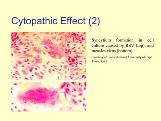 Cytopathic Effect (2)
                  Syncytium formation in cell
                  culture caused by RSV (top), and
                  measles virus (bottom).
                  (courtesy of Linda Stannard, University of Cape
                  Town, S.A.)
 