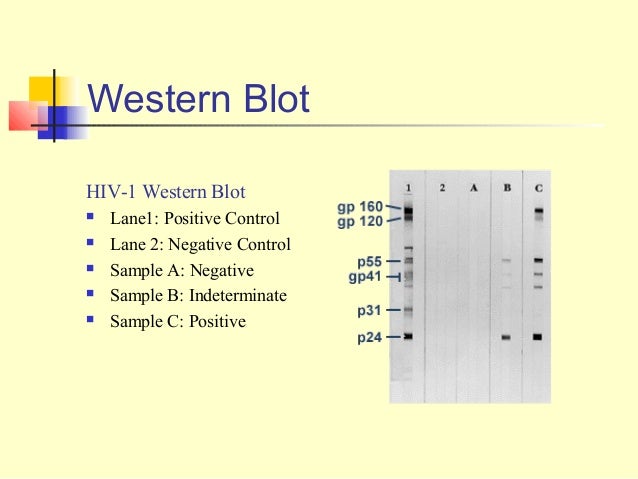 western blot hiv quest lab name western blot hiv quest lab name