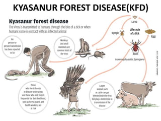 KYASANUR FOREST DISEASE(KFD)
 