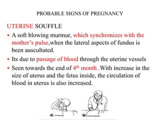PROBABLE SIGNS OF PREGNANCY
UTERINE SOUFFLE
 A soft blowing murmur, which synchronizes with the
mother’s pulse,when the lateral aspects of fundus is
been auscultated.
 Its due to passage of blood through the uterine vessels
 Seen towards the end of 4th month .With increase in the
size of uterus and the fetus inside, the circulation of
blood in uterus is also increased.
 