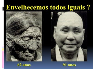 Envelhecemos todos iguais ?




   62 anos        91 anos
 