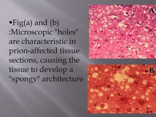 Viroids and prions | PPTX