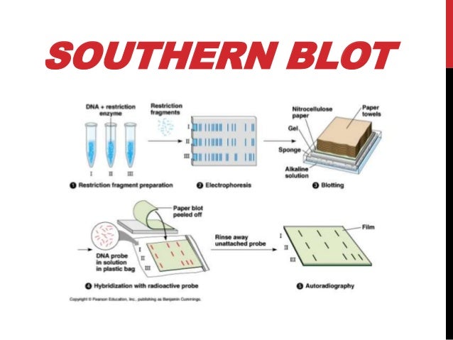 Diferencia Entre Southern Blot Y Northern Blot