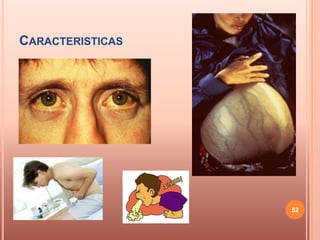 CARACTERISTICAS




                  52
 