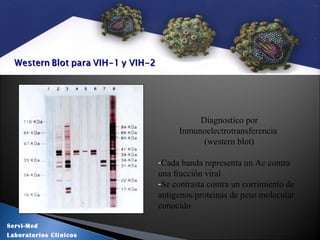 Diagnostico por
Inmunoelectrotransferencia
(western blot)
-Cada banda representa un Ac contra
una fracción viral
-Se contrasta contra un corrimiento de
antigenos/proteinas de peso molecular
conocido
Servi-Med
Laboratorios Clínicos
 