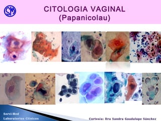 CITOLOGIA VAGINAL
(Papanicolau)
Servi-Med
Laboratorios Clínicos Cortesía: Dra Sandra Guadalupe Sánchez
 