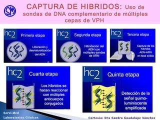 CAPTURA DE HIBRIDOS: Uso de
sondas de DNA complementario de múltiples
cepas de VPH
Servi-Med
Laboratorios Clínicos Cortesía: Dra Sandra Guadalupe Sánchez
 