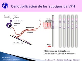Membranas de nitrocelulosa
Con las sondas virales específicas
Servi-Med
Laboratorios Clínicos Cortesía: Dra Sandra Guadalupe Sánchez
 