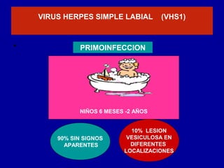 NIÑOS 6 MESES -2 AÑOS
VIRUS HERPES SIMPLE LABIAL (VHS1)
• PRIMOINFECCION
90% SIN SIGNOS
APARENTES
10% LESION
VESICULOSA EN
DIFERENTES
LOCALIZACIONES
 