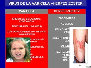 VIRUS DE LA VARICELA –HERPES ZOSTER
VARICELA HERPES ZOSTER
EPIDEMICA, ESTACIONAL,
CONTAGIOSA
EDAD INFANTIL (2-6 AÑOS)
CONTAGIO: Contacto con vesiculas,
vía respiratoria
Virus se multiplica en celulas del
epitelio respiratorio
Invade :Sangre, piel, pulmones,
visceras
ERUPCION
MACULA-PAPULA-VESCICULA-
PUSTULA
ESPORADICA
ADULTOS
PRIMOINFECCION:
VARICELA
RECURRENTE:HERPES
ZOSTER
CLINICA:
FIEBRE, ERUPCION
VESICULOSA
UNILATERAL
DOLOROSA
 
