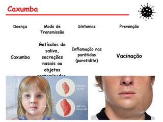 Caxumba
Doença Modo de
Transmissão
Sintomas Prevenção
Caxumba
Gotículas de
saliva,
secreções
nasais ou
objetos
contaminados.
Inflamação nas
parótidas
(parotidite)
Vacinação
 