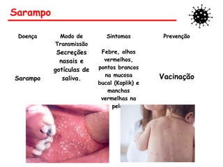 Sarampo
Doença Modo de
Transmissão
Sintomas Prevenção
Sarampo
Secreções
nasais e
gotículas de
saliva.
Febre, olhos
vermelhos,
pontos brancos
na mucosa
bucal (Koplik) e
manchas
vermelhas na
pele.
Vacinação
 