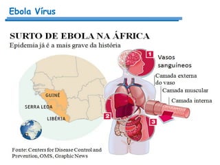 Ebola Vírus
 