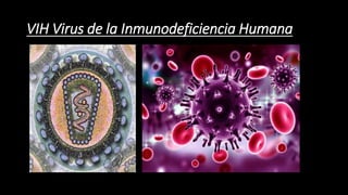 VIH Virus de la Inmunodeficiencia Humana
 