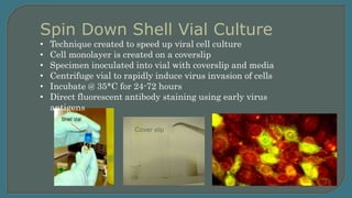 Spin Down Shell Vial Culture
• Technique created to speed up viral cell culture
• Cell monolayer is created on a coverslip...
