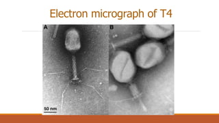 Electron micrograph of T4
 