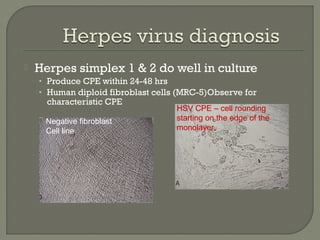  Herpes simplex 1 & 2 do well in culture
• Produce CPE within 24-48 hrs
• Human diploid fibroblast cells (MRC-5)Observe for
characteristic CPE
Negative fibroblast
Cell line
HSV CPE – cell rounding
starting on the edge of the
monolayer.
 