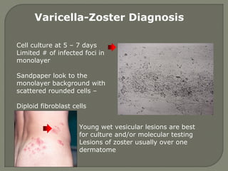 Varicella-Zoster Diagnosis
Cell culture at 5 – 7 days
Limited # of infected foci in
monolayer
Sandpaper look to the
monolayer background with
scattered rounded cells –
Diploid fibroblast cells
Young wet vesicular lesions are best
for culture and/or molecular testing
Lesions of zoster usually over one
dermatome
 