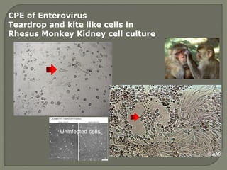 CPE of Enterovirus
Teardrop and kite like cells in
Rhesus Monkey Kidney cell culture
Uninfected cells
 