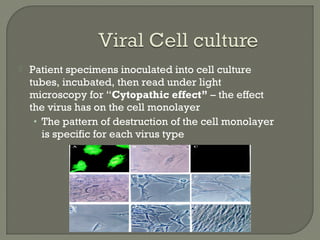  Patient specimens inoculated into cell culture
tubes, incubated, then read under light
microscopy for “Cytopathic effect” – the effect
the virus has on the cell monolayer
• The pattern of destruction of the cell monolayer
is specific for each virus type
 