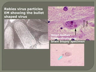 Rabies virus particles
EM showing the bullet
shaped virus
Negri bodies –
Intracytoplasmic
brain biopsy specimen
 