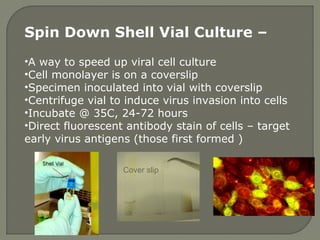 Spin Down Shell Vial Culture –
•A way to speed up viral cell culture
•Cell monolayer is on a coverslip
•Specimen inoculated into vial with coverslip
•Centrifuge vial to induce virus invasion into cells
•Incubate @ 35C, 24-72 hours
•Direct fluorescent antibody stain of cells – target
early virus antigens (those first formed )
Cover slip
 