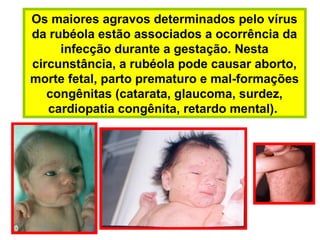 Os maiores agravos determinados pelo vírus
da rubéola estão associados a ocorrência da
infecção durante a gestação. Nesta
circunstância, a rubéola pode causar aborto,
morte fetal, parto prematuro e mal-formações
congênitas (catarata, glaucoma, surdez,
cardiopatia congênita, retardo mental).
 