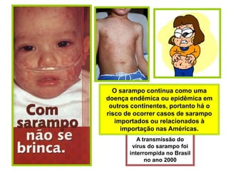 Orientação ao Viajante SarampoO sarampo continua como uma doença endêmica ou epidêmica em outros continentes, portanto há o risco de ocorrer casos de sarampo importados ou relacionados à importação nas Américas. A transmissão do vírus do sarampo foi interrompida no Brasil no ano 2000 