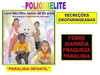 POLIOMIELITESECREÇÕESOROFARINGEANASFEBREDIARRÉIAFRAQUEZAPARALISIA“PARALISIA INFANTIL”