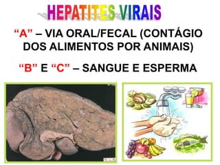 HEPATITES VIRAIS“A” – VIA ORAL/FECAL (CONTÁGIODOS ALIMENTOS POR ANIMAIS)“B” E “C” – SANGUE E ESPERMA