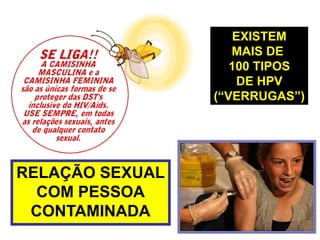 EXISTEMMAIS DE 100 TIPOSDE HPV(“VERRUGAS”)RELAÇÃO SEXUALCOM PESSOACONTAMINADA