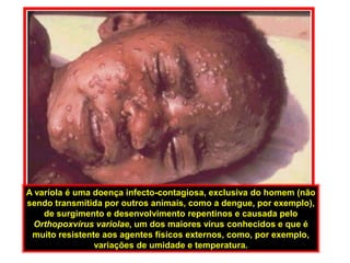 A varíola é uma doença infecto-contagiosa, exclusiva do homem (não sendo transmitida por outros animais, como a dengue, por exemplo), de surgimento e desenvolvimento repentinos e causada pelo Orthopoxvírus variolae, um dos maiores vírus conhecidos e que é muito resistente aos agentes físicos externos, como, por exemplo, variações de umidade e temperatura. 