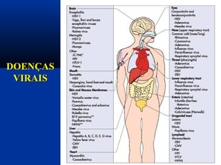 DOENÇASDOENÇAS
VIRAISVIRAIS
 