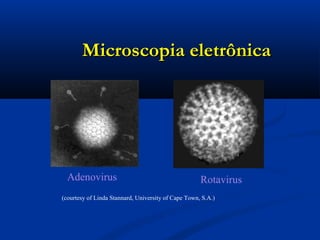 Microscopia eletrônicaMicroscopia eletrônica
Adenovirus Rotavirus
(courtesy of Linda Stannard, University of Cape Town, S.A.)
 