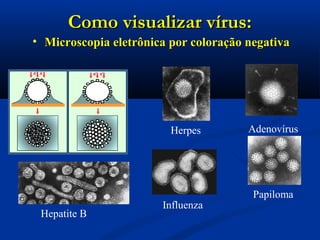 Como visualizar vírus:Como visualizar vírus:
• Microscopia eletrônica por coloração negativaMicroscopia eletrônica por coloração negativa
Adenovírus
Papiloma
Herpes
Influenza
Hepatite B
 