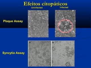 Efeitos citopáticosEfeitos citopáticos
UninfectedUninfected InfectedInfected
Plaque AssayPlaque Assay
Syncytia AssaySyncytia Assay
 