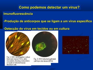 Como podemos detectar um virus?Como podemos detectar um virus?
ImunofluorescênciaImunofluorescência
-Produção de anticorpos que se ligam a um vírus específicoProdução de anticorpos que se ligam a um vírus específico
-Detecção do vírus em tecidos ou em culturaDetecção do vírus em tecidos ou em cultura
 