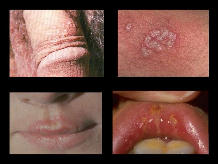 Virosis y piodermitis