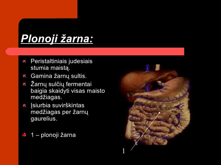 Virskinim sistema