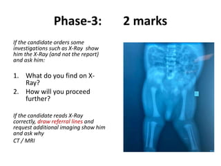 Phase-3: 2 marks
If the candidate orders some
investigations such as X-Ray show
him the X-Ray (and not the report)
and ask him:
1. What do you find on X-
Ray?
2. How will you proceed
further?
If the candidate reads X-Ray
correctly, draw referral lines and
request additional imaging show him
and ask why
CT / MRI
 