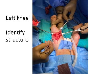 Left knee
Identify
structure
 