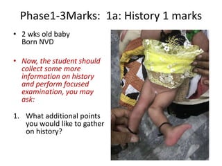 Phase1-3Marks: 1a: History 1 marks
• 2 wks old baby
Born NVD
• Now, the student should
collect some more
information on history
and perform focused
examination, you may
ask:
1. What additional points
you would like to gather
on history?
 
