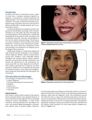 104 Winter 2014 • Volume 29 • Number 4
Introduction
Excellence will never be achieved by chance; rather,
it comes from a consistent, systematic approach to
diagnosis, communication, treatment planning, and
implementation. The incorporation of protocols and
checklists1-7
for quality control and information man-
agement help to guarantee that every critical point is
performed effectively, is double-checked, and is com-
municated correctly.
To obtain predictable and consistent outcomes, the
practitioner should deﬁne the design of the restorative
treatment at an early stage. The data must guide the
succeeding phases of the rehabilitation,8
scientiﬁcally
integrating all of the patient’s needs and desires and
the patient’s functional, structural, and biological is-
sues into the esthetic treatment design. The data serve
as a frame of reference for the treatment that will be
performed.9,10
However, many of these pieces of infor-
mation may not be taken into consideration if their
real meaning is not transferred in an adequate way to
the design of the restorations.
Digital Smile Design is a multipurpose digital tool
with clinically relevant advantages. It can strengthen
esthetic diagnostic abilities, improve communication
among team members, create predictable systems
throughout the treatment phases, enhance patients’
education and motivation through visualization, and
increase the effectiveness of case presentation. Be-
cause using DSD can make diagnosis more effective
and treatment planning more consistent, the effort
required to implement it is worthwhile and will make
the treatment sequence more logical and straightfor-
ward, saving time and materials and reducing the cost
of treatment.
Clinically Relevant Advantages
The advantages of using DSD are as follows:
• esthetic diagnosis
• treatment planning and communication
• feedback
• patient care
• case presentation
• education.
Esthetic Diagnosis
DSD allows a careful esthetic analysis of the patient’s
facial and dental features and a gradual discovery of
many critical factors that might have been overlooked
during the clinical, photographic, or study model
evaluation. Drawing reference lines and shapes over
extra- and intraoral digital photographs in presenta-
tion software (such as Keynote [Apple; Cupertino,
CA]; PowerPoint [Microsoft; Redmond, WA]; DSD software; or Smile De-
signer Pro [Tasty Tech; Toronto, Ontario, CA]), following a predetermined
sequence, helps widen the diagnostic vision. This visualization process
also helps the team to assess and understand limitations and risk fac-
tors such as asymmetries, disharmonies, and esthetic principle violations,
adding critical data to the process of treatment planning.1
Choosing the
appropriate technique is easier once problems have been identiﬁed and
the solution clearly visualized. The main steps related to diagnosis are
shown in Figures 1-11.
Figure 1: Preoperative extraoral view 20 years before first appointment
showing ankylosed teeth #21 and #22.
Figure 2: Preoperative extraoral view at first appointment.
 