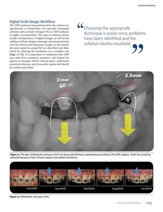 109Journal of Cosmetic Dentistry
Digital Smile Design Workflow
The DSD protocol was performed by the authors us-
ing Keynote or PowerPoint, but specially developed
software such as Smile Designer Pro or DSD software
is highly recommended. This type of software allows
simple manipulation of digital images, as well as the
addition of lines, shapes, drawings, and measurements
over the clinical and laboratory images. In this article,
the main steps for using DSD are described and illus-
trated by showing the resolution of a complex case
(Figs 12-31). It is important to emphasize that DSD
was used from treatment inception and helped the
patient to visualize all her clinical issues, understand
potential solutions, and choose the option that best ﬁt
her needs and wishes.
Figure 12: The plan: Orthodontic extrusion of #11 for bone and soft-tissue repositioning according to the DSD analysis. Tooth #23 would be
extracted because of lack of bone support and esthetic limitations.
Coachman/Calamita
Figure 13: Orthodontic extrusion of #11.
Choosing the appropriate
technique is easier once problems
have been identified and the
solution clearly visualized.
 