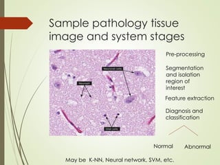 Sample pathology tissue
image and system stages
Pre-processing
Segmentation
and isolation
region of
interest
Feature extraction
Diagnosis and
classification
Normal Abnormal
May be K-NN, Neural network, SVM, etc.
 