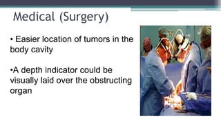 Medical (Surgery)
• Easier location of tumors in the
body cavity
•A depth indicator could be
visually laid over the obstructing
organ
 