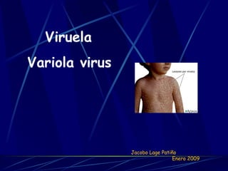 Viruela Variola virus Jacobo Lage Patiño  Enero 2009 