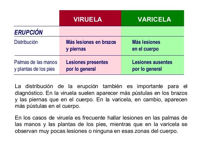 Viruela